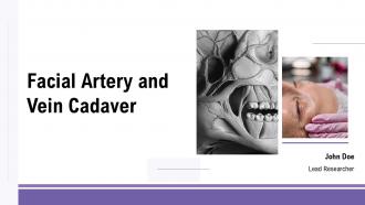Facial Artery And Vein Cadaver PPT Presentation ACP