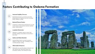Factors Contributing To Oedema Formation PPT Slides ST AI SS