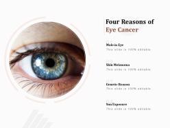 Four reasons of eye cancer