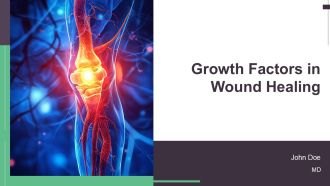 Growth Factors In Wound Healing PPT PowerPoint AT