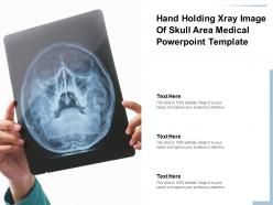 Hand holding xray image of skull area medical powerpoint template