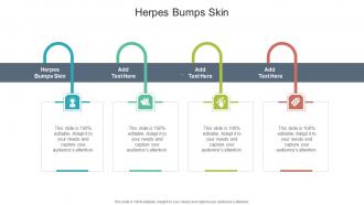 Herpes Bumps Skin In Powerpoint And Google Slides Cpb