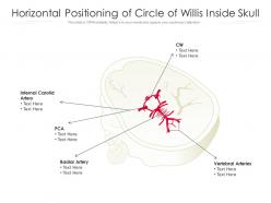 Horizontal positioning of circle of willis inside skull