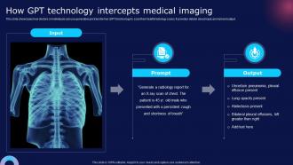 How Gpt Technology Intercepts Medical Imaging How Chatgpt Can Transform Healthcare Chatgpt SS