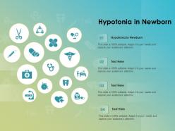 Hypotonia in newborn ppt powerpoint presentation slides styles
