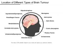 Location of different types of brain tumor