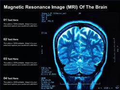 Magnetic resonance image mri of the brain