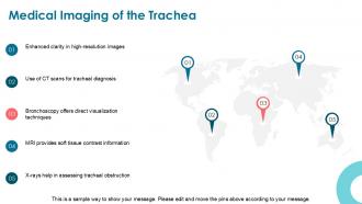 Main Function Of The Trachea PPT Outline ACP Adaptable Impressive
