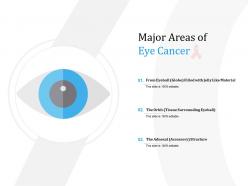 Major areas of eye cancer