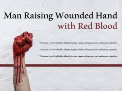 Man raising wounded hand with red blood
