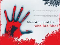 Man wounded hand with red blood