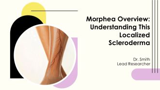 Morphea Overview Understanding This Localized Scleroderma PPT Graphics AT