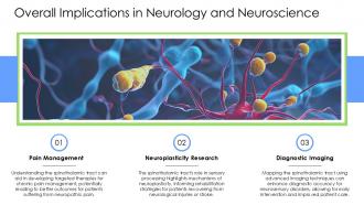Overall Implications In Neurology And Neuroscience Spinothalamic Tract PPT Slides ACP