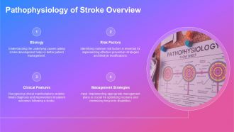 Pathophysiology Of Stroke For Professionals PPT PowerPoint AT Appealing Content Ready