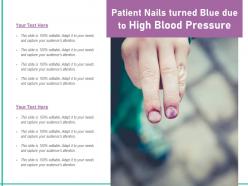 Patient nails turned blue due to high blood pressure