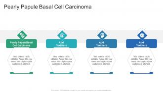 Pearly Papule Basal Cell Carcinoma In Powerpoint And Google Slides Cpb