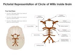 Pictorial representation of circle of willis inside brain
