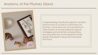 Pituitary Tumor Surgery Craniotomy PPT Template ACP Ideas Engaging