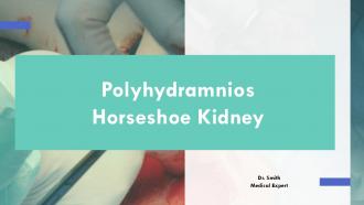 Polyhydramnios Horseshoe Kidney PPT Demonstration ACP