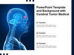Powerpoint Template And Background With Cerebral Tumor Medical
