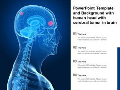 Powerpoint template and background with human head with cerebral tumor in brain