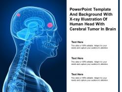 Powerpoint template and background with x ray illustration of human head with cerebral tumor in brain