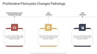 Proliferative Fibrocystic Changes Pathology In Powerpoint And Google Slides Cpb
