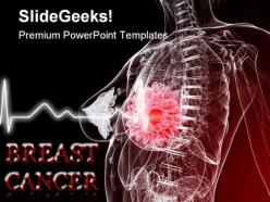 Breast cancer medical powerpoint templates and powerpoint backgrounds 0211