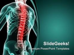 Painful spine medical powerpoint backgrounds and templates 1210