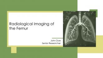 Radiological Imaging Of The Femur PPT Graphics AT