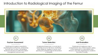 Radiological Imaging Of The Femur PPT Graphics AT Ideas Aesthatic