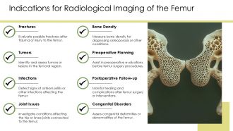 Radiological Imaging Of The Femur PPT Graphics AT Editable Aesthatic