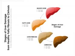 Stages of liver damage from healthy fatty fibrosis to cirrhosis