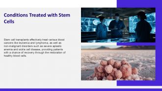 Stem Cell Transplant PPT Example ACP Image Images