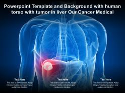 Template and background with human torso with tumor in liver our cancer medical