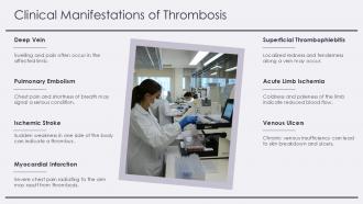 Thrombosis Pathology PPT Outline ACP Downloadable Unique