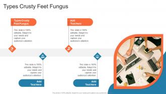 Types Crusty Feet Fungus In Powerpoint And Google Slides Cpb