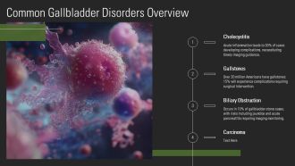 Understanding Gallbladder Imaging Stones And Complications PPT PowerPoint AT Images Researched