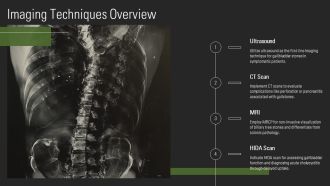 Understanding Gallbladder Imaging Stones And Complications PPT PowerPoint AT Unique Researched