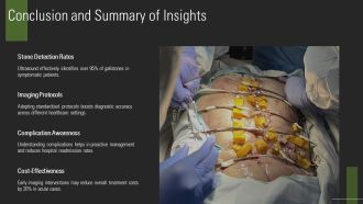 Understanding Gallbladder Imaging Stones And Complications PPT PowerPoint AT Aesthatic Researched