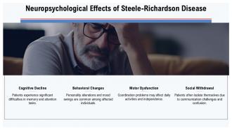 Understanding Steele Richardson Disease Symptoms Causes And Treatments PPT Template ST AI Content Ready Downloadable
