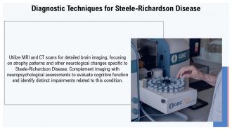 Understanding Steele Richardson Disease Symptoms Causes And Treatments PPT Template ST AI Compatible Downloadable