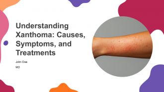 Understanding Xanthoma Causes Symptoms And Treatments PPT Example ST AI