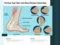 Various foot skin and bone disease described