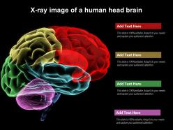 X ray image of a human head brain