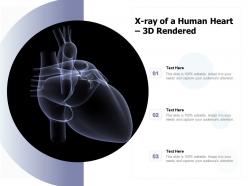 X ray of a human heart 3d rendered