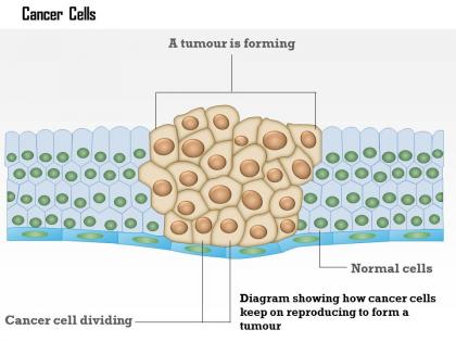 0614 cancer cells medical images for powerpoint