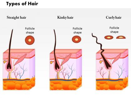 0814 types of hair medical images for powerpoint