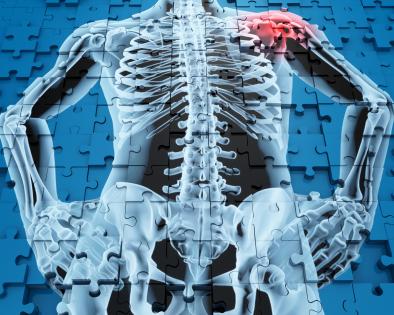 1114 human anatomy with shoulder pain stock photo