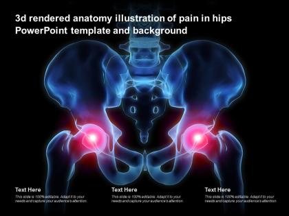 3d rendered anatomy illustration of pain in hips powerpoint template and background